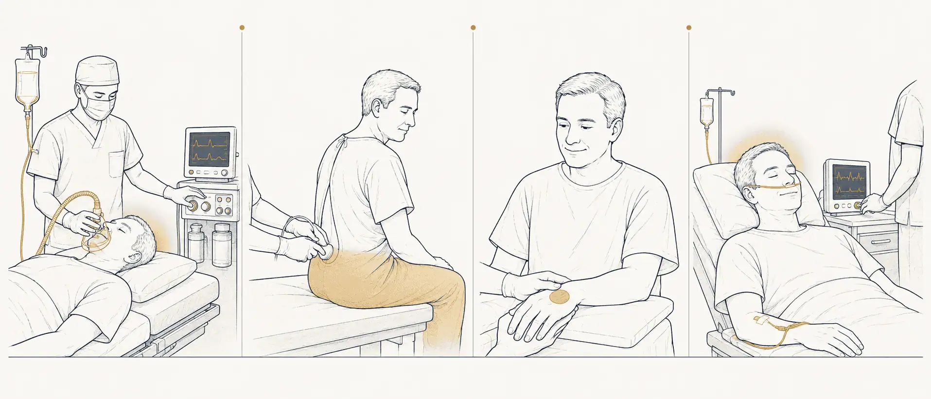 Editorial illustration showing the four main types of anaesthesia — general, regional, local, and sedation — with the same patient depicted in each setting.